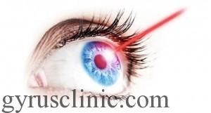 جراحی لیزر چشم1