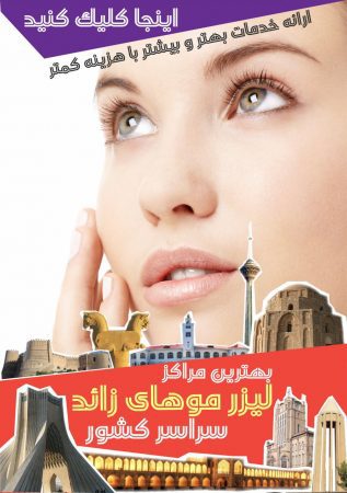 لیزر مو